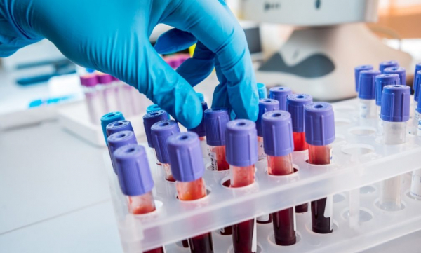 Супербактерии могут убить более 39 млн человек к 2050 году — исследование Супербактерии могут убить более 39 млн человек к 2050 году — исследование